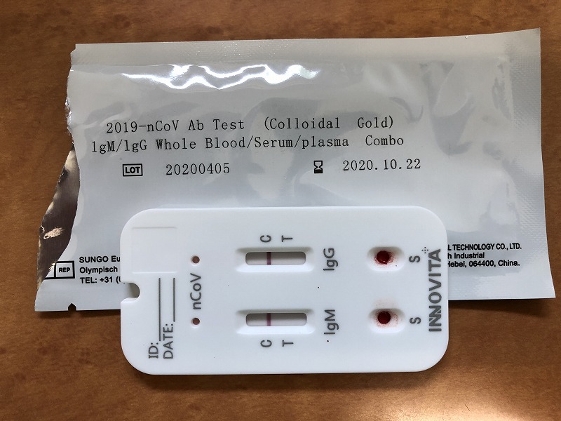 新型コロナウィルス抗体検査