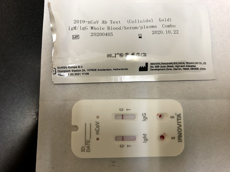 新型コロナウィルス抗体検査