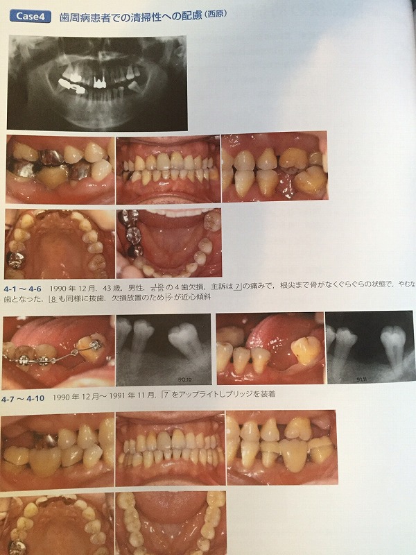 座談会